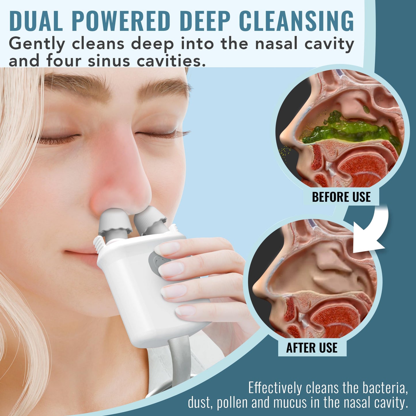 NASALFRESH MD Premium Bundle–Dual Powered Nasal Irrigation System Nasal Rinse and Wash, Sinus Decongestant Relief System, 60 Saline Packets, Case, Rechargeable, 2 Sets of Nose Pillows–Snoring Remedy