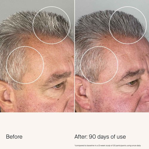 Living Proof Scalp Care Density Serum