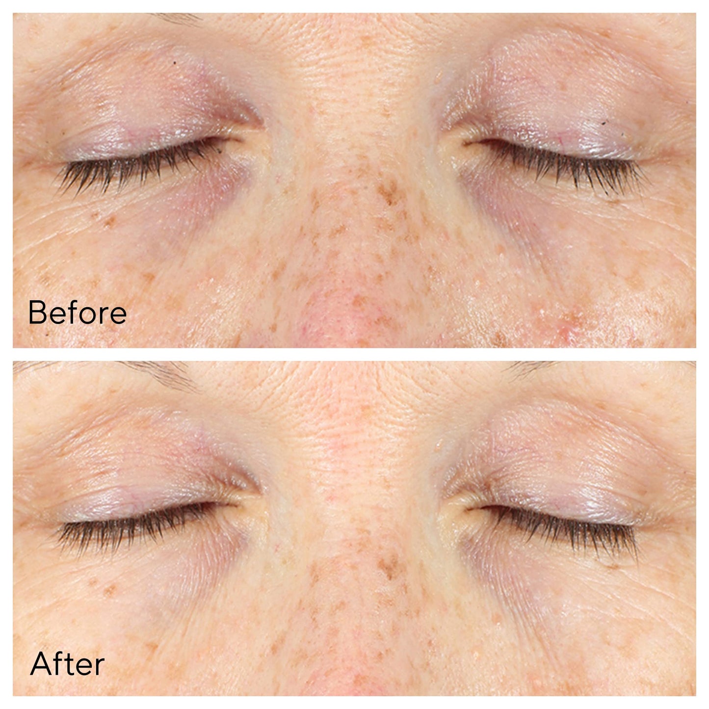 Murad Vita-C Eyes Dark Circle Corrector - Environmental Shield Vitamin C Brightening Serum - Anti-Aging Treatment for Puffiness