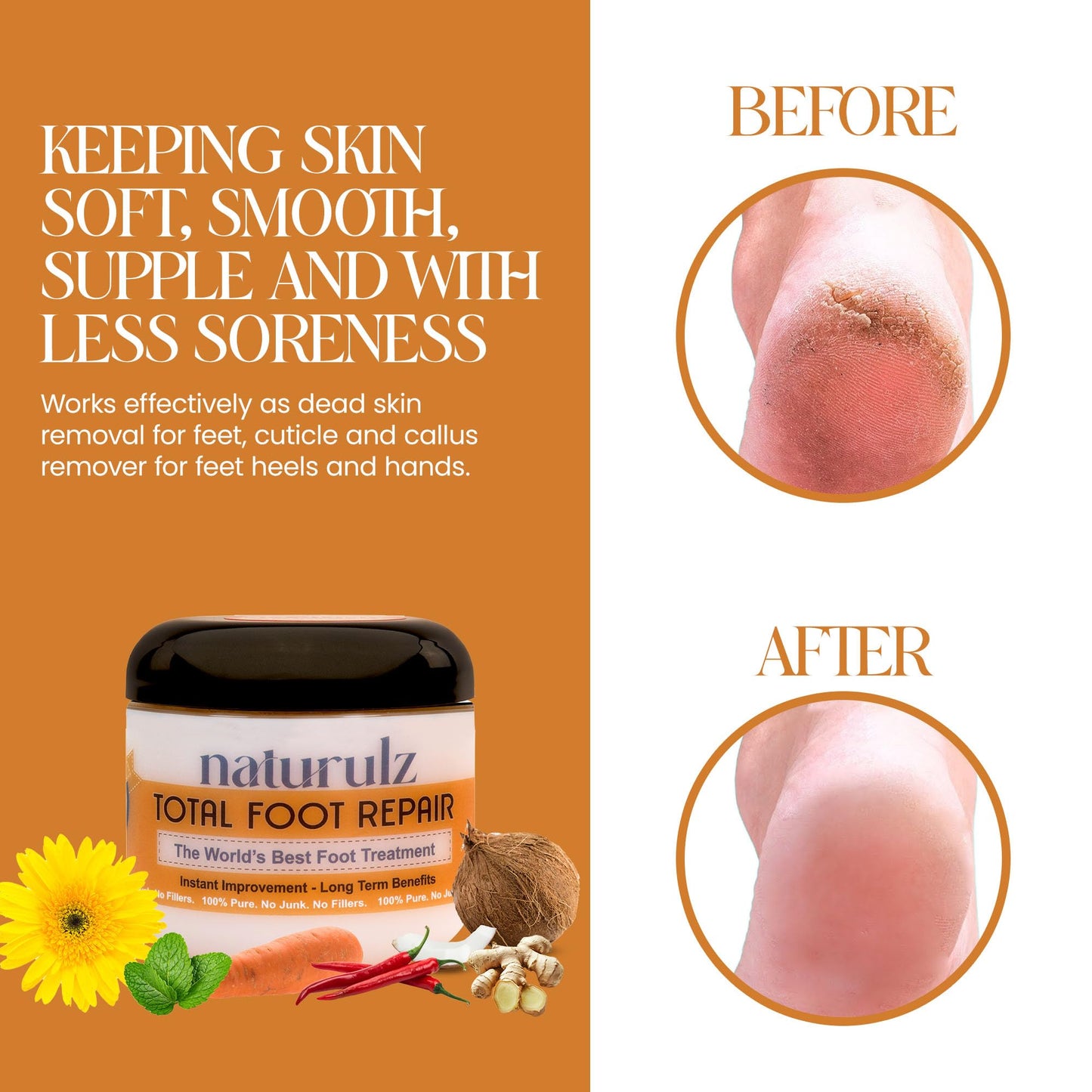 Naturulz Total Foot Repair 4oz - No Junk Foot Cream for Dry, Rough Skin & Cracked Heels, Lightweight & Compact Moisturizer for F