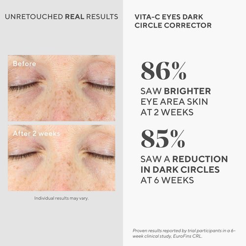 Murad Vita-C Eyes Dark Circle Corrector – Gold-Stabilized Vitamin C, Algae, and Cucumber Eye Serum for Brightening, Reducing Puffiness, and Smoothing Fine Lines – 0.5 Fl Oz