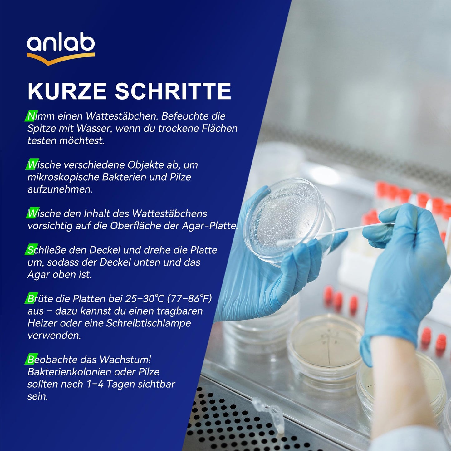 Nutrient Agar Petri Dishes Science Project Kit | Pre-Poured Agar Plates and Cotton Swabs for Science Experiments | Bacteria Science Kit - Sealed Separately (Items of 10)