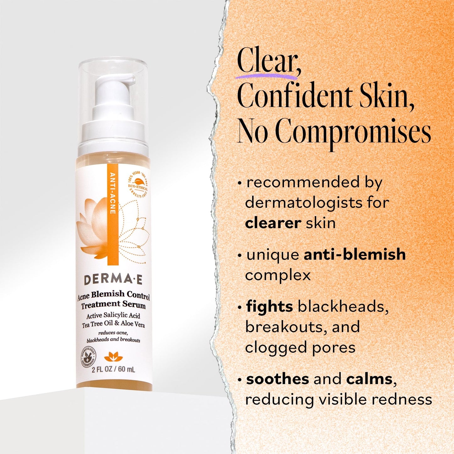 DERMA E Acne Spot Treatment, Acne Blemish Control Treatment Serum, 2 Fl Oz, Clinically Studied to Help Fight Blackheads, Breakou