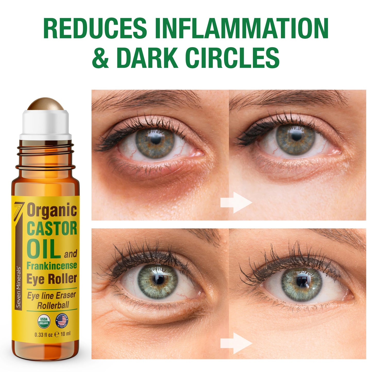 Seven Minerals Organic Castor Oil Roll On Eye Roller for Under Eye Bags, Dark Circles & Wrinkles - Organic Blend of Castor Oil A