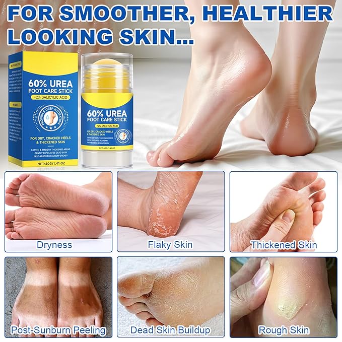Urea Cream 60 Percent for Feet, 2% Salicylic Acid Urea Foot Cream for Cracked Heels and Dry Skin, Deep Moisturizing, Cracked Heel Repair Cream, Repairing Creams for Heels, Knees, Elbows & Hands (2)