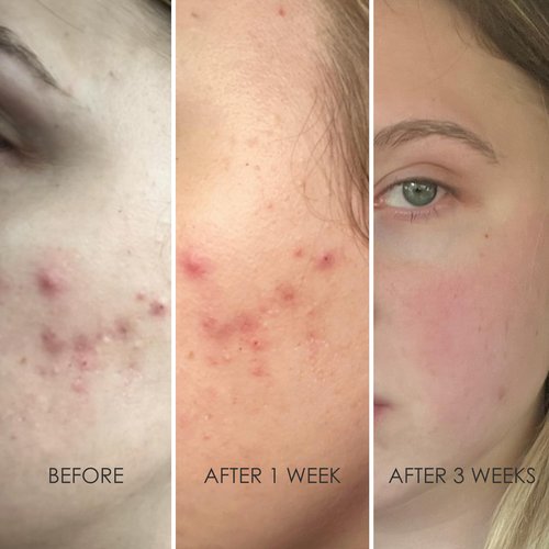 REFLEKT 4 Smoothing Squalane Eye & Lip Treatment Cream