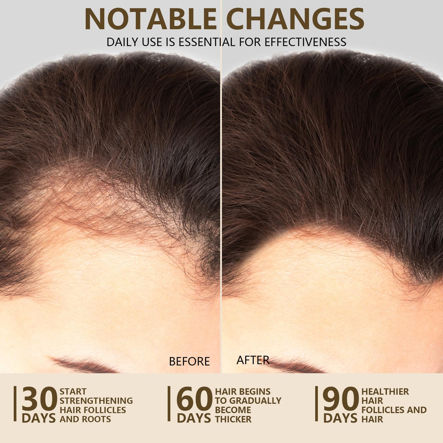 Ktintar 100% Natural Raw Batana Oil for Hair Growth, Unrefined & Organic Dr Sebi Hair Growth Oil From Honduras, Prevents Hair Lo