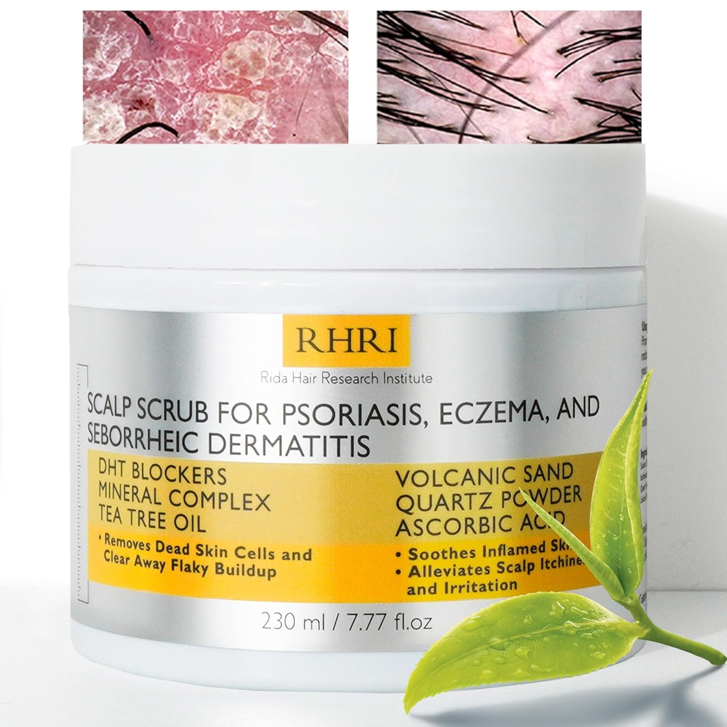 Anti Fungal Pre Shampoo Scalp Scrub for Psoriasis, Eczema & Seborrheic Dermatitis | DHT Blockers, Mineral Complex & Tea Tree Oil | Soothes Scalp and Promotes Hair Growth for Men & Women