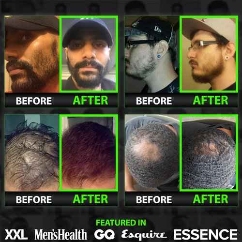 Beard Growth Kit w/ 2X Biotin Beard Balm for Men & Mustache Wax + GROW 11-in-1 Mens Shampoo & Conditioner (Hair Growth Shampoo for Men w/Biotin) + GROW Facial Hair Growth Oil (Made in America)
