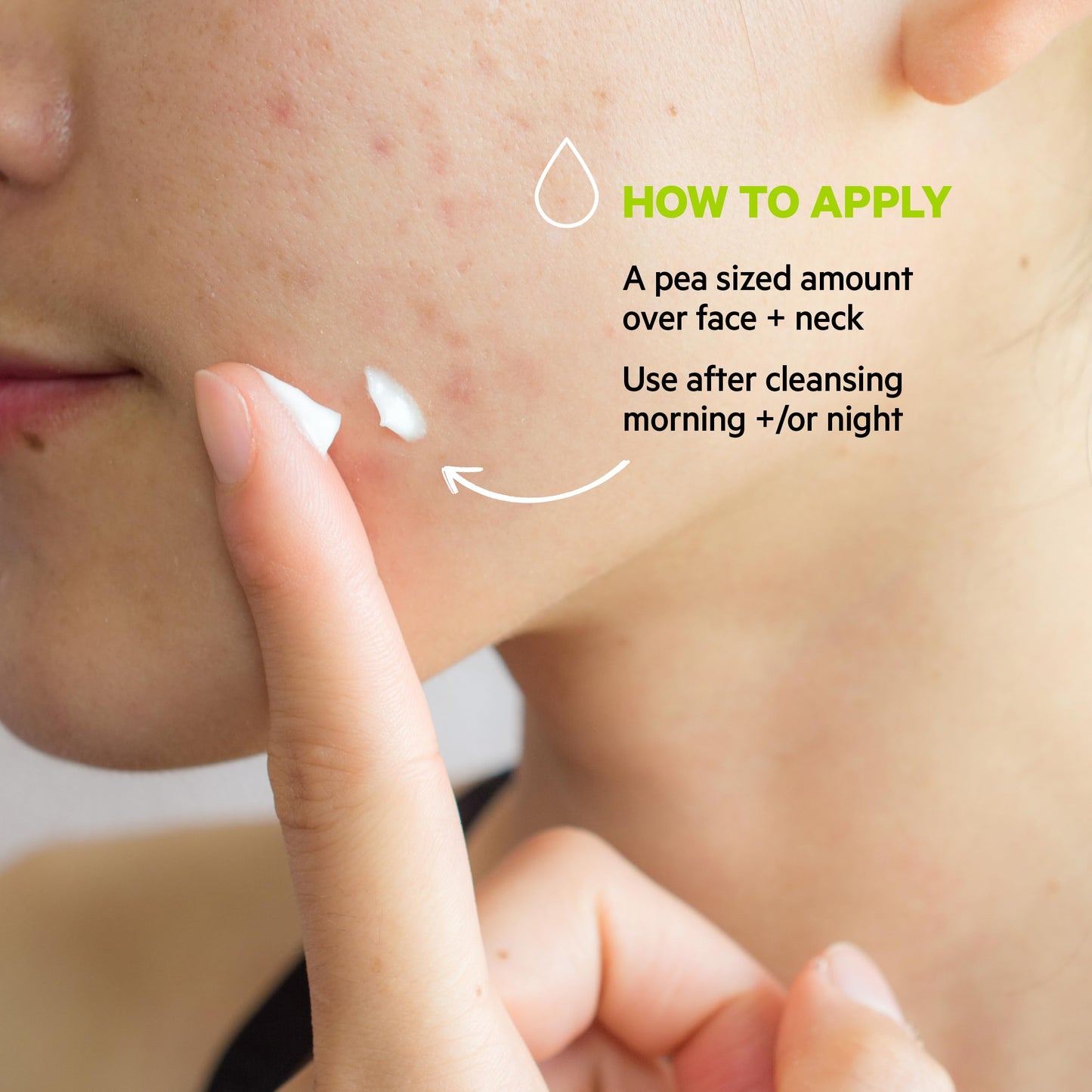 SVR Sebiaclear Moisturizing Face Cream - Soothing Moisturizer, Reduces the appearance of marks, with Niacinamide, Hyaluronic Aci