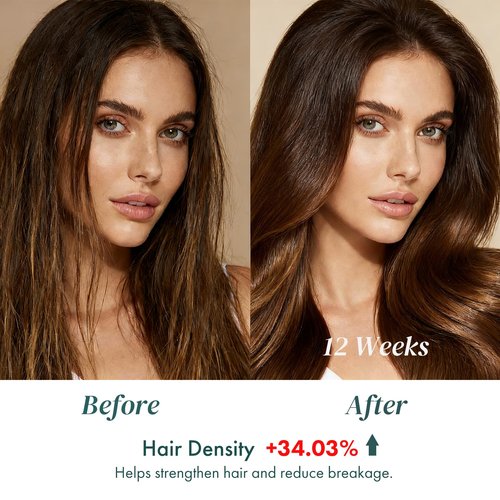 ALFHEIM Saw Palmetto Scalp Serum for Boost Follicle - Infused With Caffeine, Biotin for Thicker Hair - Balance Scalp, Rejuvenate Hair Follicles ＆ Improve Hair Density - 1.69 fl oz + Serum Applicator