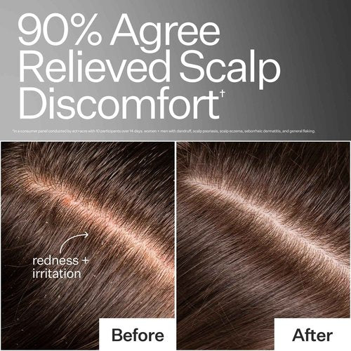ACT+ ACRE Microbiome Cooling Scalp Serum - Instant Relief for Dry Itchy Scalp & Loose Flakes - Peppermint Oil & Amino Acid for Scalp Balance - Natural, Vegan, Paraben-Free Formula - 2.2 fl oz