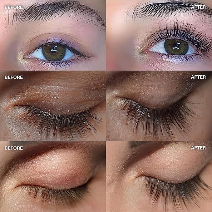 ForChics Lash Growth and Volume Duo - Growth Serum + Nourishing Mascara | 24/7 Lash Transformation System - Prostaglandin-Free, Hormone-Free - Instant Volume + Long-Term Growth