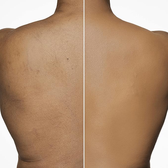 Dermablend Leg and Body Makeup Foundation with SPF 25, 35C Light Beige, 3.4 Fl. Oz.