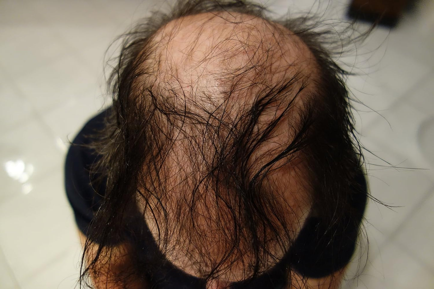 Hair Building Fibers 200 Grams 7 Oz. With Bottle By Finally Hair 50g*4 (Grey (medium gray))