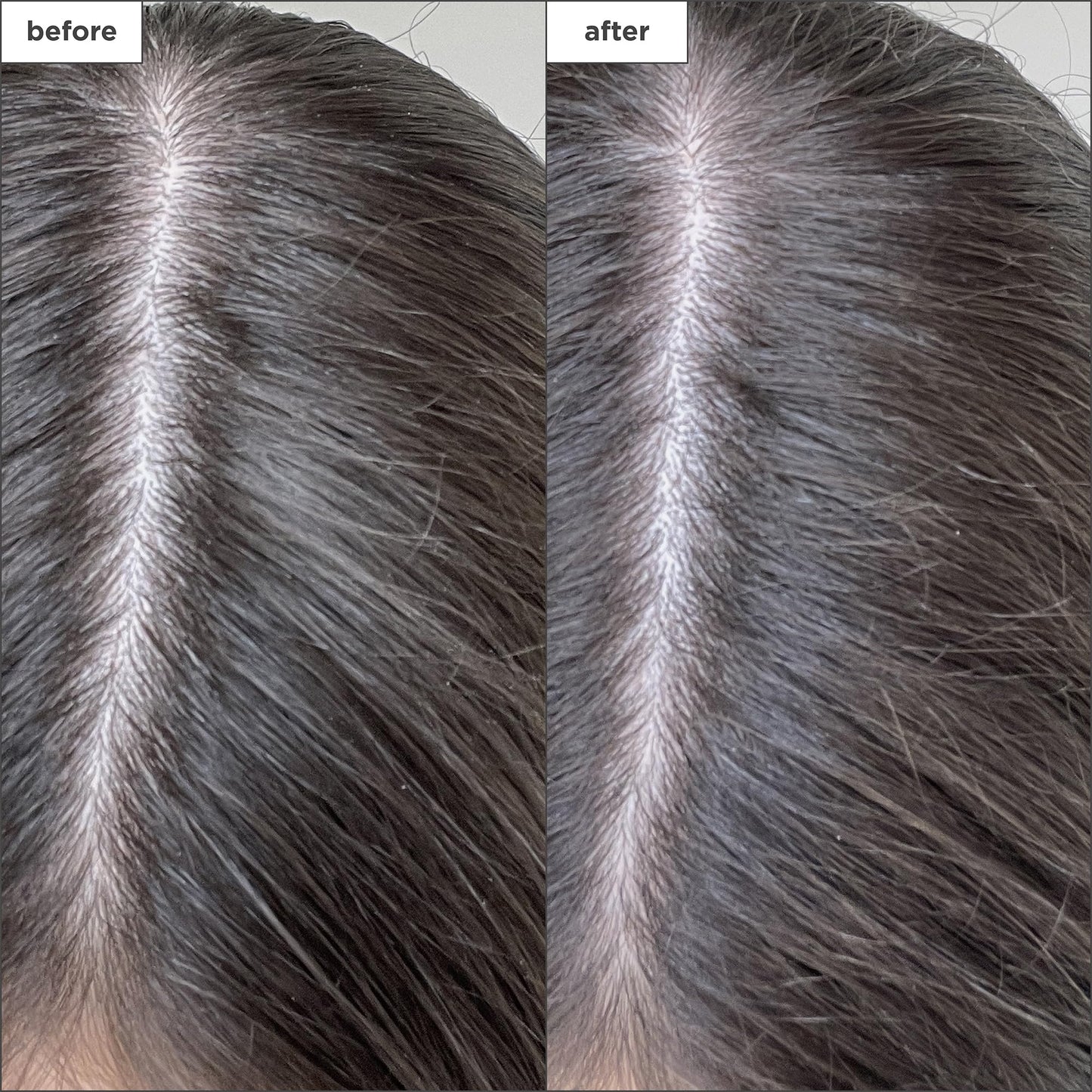 Briogeo Scalp Revival Charcoal + Biotin Dry Shampoo, Clarifying Shampoo Scalp Cleanser for Dry Scalp & Itchy Scalp, Featuring Te