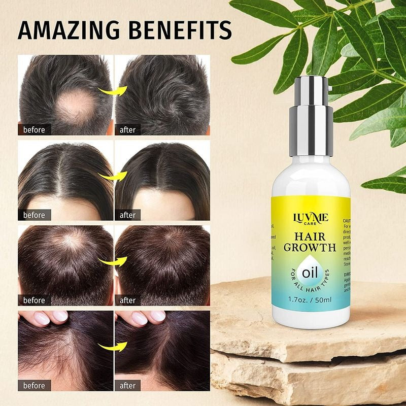 Biotin Hair Growth Oil Hair Growth Serum for Thicker Longer, Prevent Hair Loss