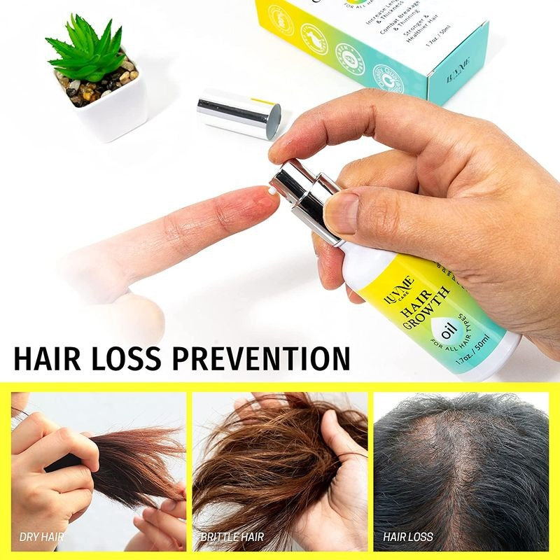 Biotin Hair Growth Oil Hair Growth Serum for Thicker Longer, Prevent Hair Loss
